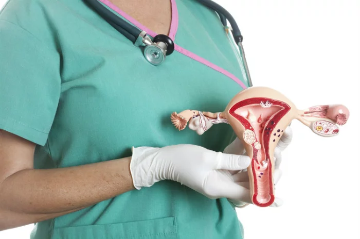 Лікування дисплазії шийки матки