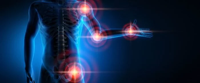 Обстеження, що може призначити ревматолог