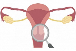 Лікування патологій шийки матки