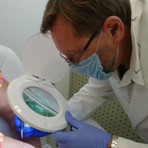 Видалення новоутворень шкіри радіохвильовим методом: усе, що варто знати